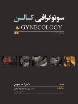 سونوگرافی کالن IN Gynecology 2017